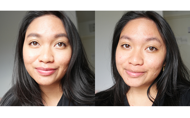 before after micellar oil