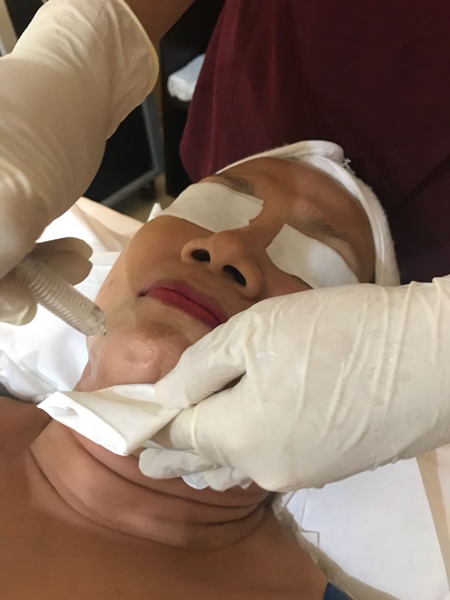Aesthetic Skin Club Oxygen Therapy