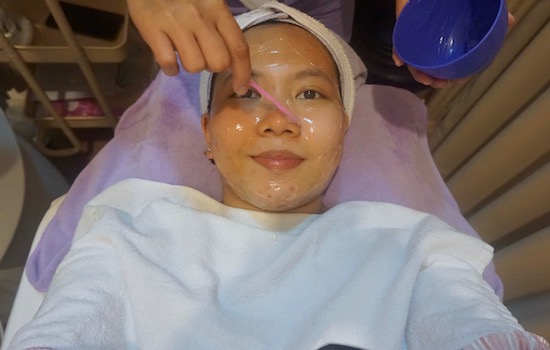 Mencoba Venus Acne Treatment Jerawat Aktif Tanpa Sakit